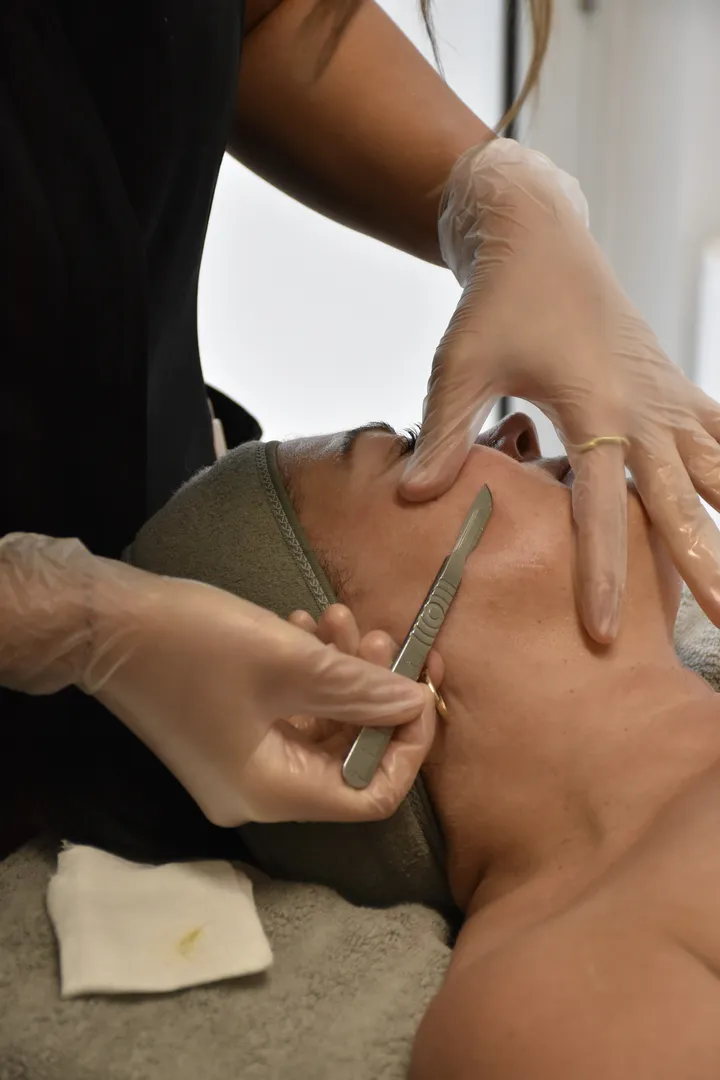 Facial dermaplaning treatment by a professional esthetician.